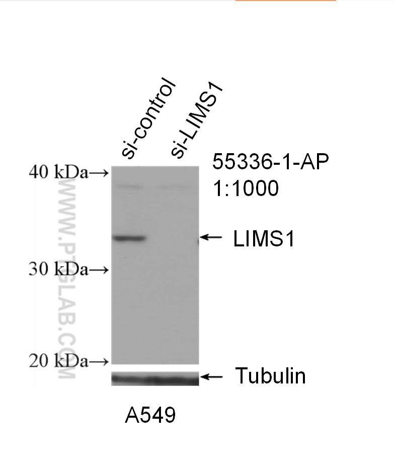 Western Blot (WB) analysis of A549 cells using LIMS1 Polyclonal antibody (55336-1-AP)