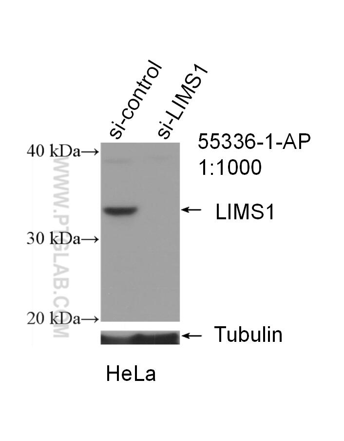 Western Blot (WB) analysis of HeLa cells using LIMS1 Polyclonal antibody (55336-1-AP)