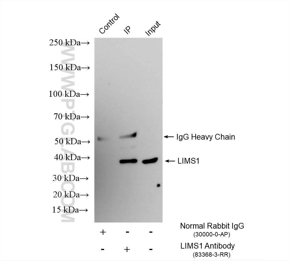 IP experiment of HeLa using 83368-3-RR (same clone as 83368-3-PBS) Immunoprecipitation (IP) experiment of HeLa cells using LIMS1 Recombinant monoclonal antibody (83368-3-RR)