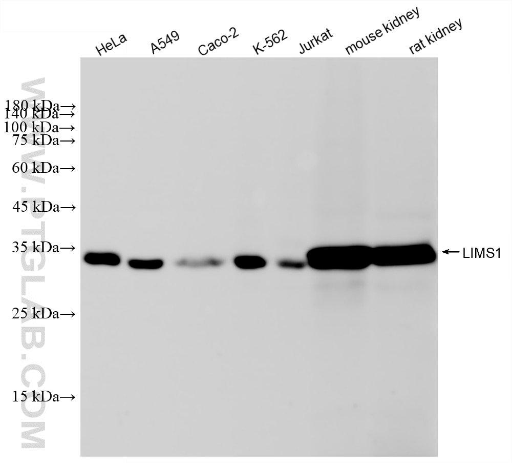 WB analysis using 83368-3-RR (same clone as 83368-3-PBS) Western Blot (WB) analysis of various lysates using LIMS1 Recombinant monoclonal antibody (83368-3-RR)