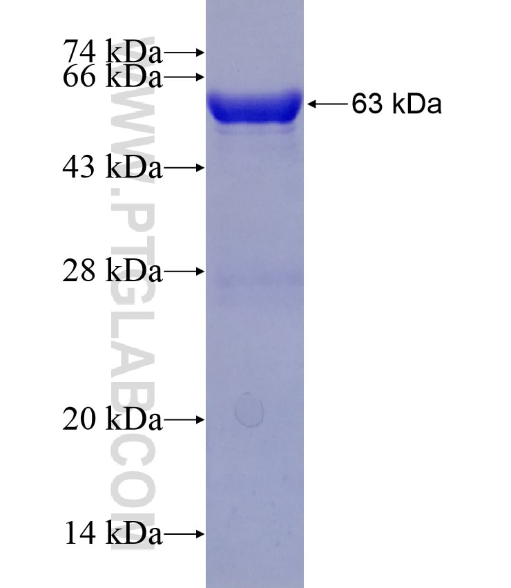 LIMS1 fusion protein Ag14764 SDS-PAGE