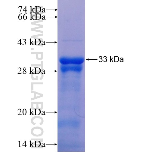 LIMS1 fusion protein Ag14956 SDS-PAGE