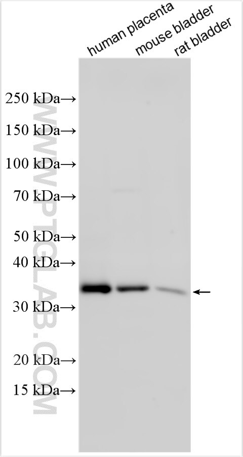 Western Blot (WB) analysis of various lysates using LIMS2 Polyclonal antibody (55300-1-AP)