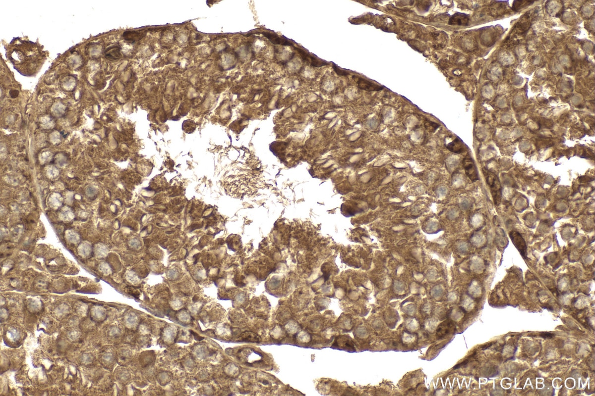 Immunohistochemistry (IHC) staining of mouse testis tissue using LIN28 Polyclonal antibody (11724-1-AP)