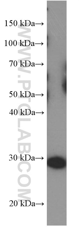 Western Blot (WB) analysis of NCCIT cells using LIN28 Monoclonal antibody (60344-1-Ig)