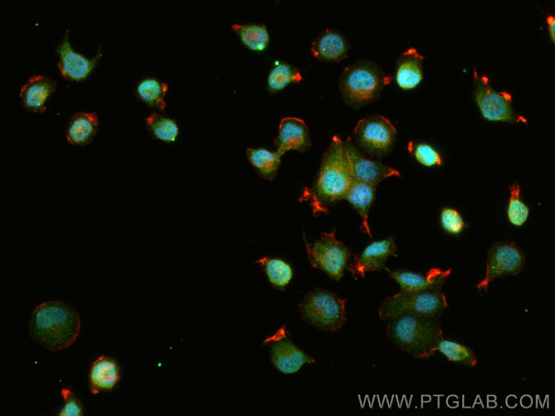 Immunofluorescence (IF) / fluorescent staining of NCCIT cells using LIN28B Polyclonal antibody (24017-1-AP)