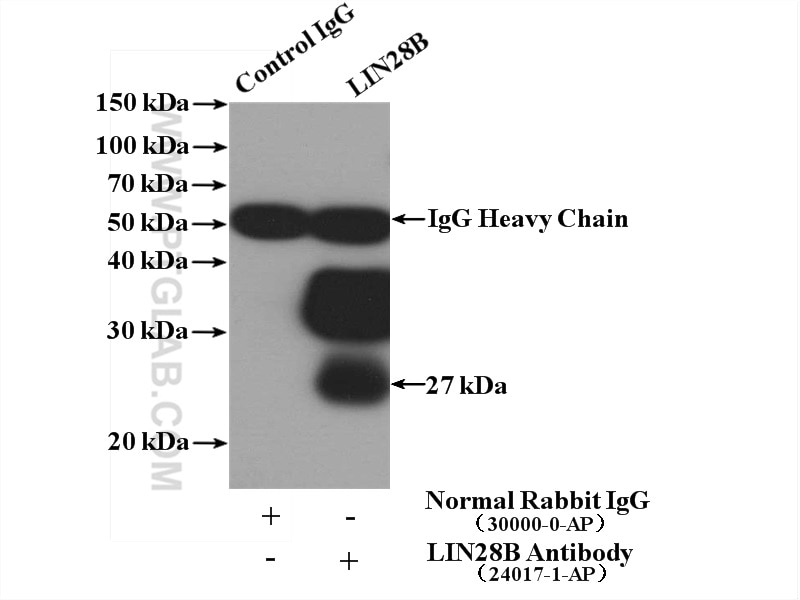 Immunoprecipitation (IP) experiment of HEK-293 cells using LIN28B Polyclonal antibody (24017-1-AP)