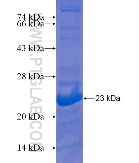 LIN28B fusion protein Ag21266 SDS-PAGE LIN28B fusion protein Ag21266 SDS-PAGE