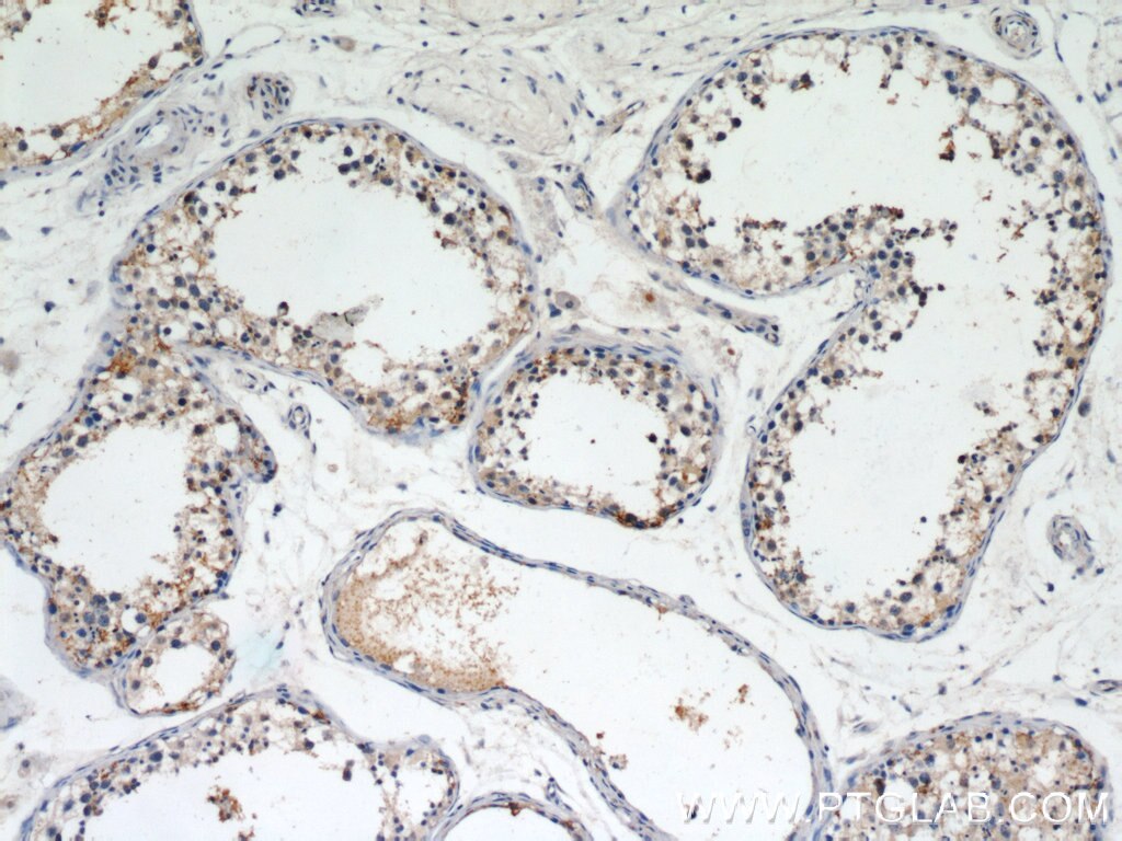 Immunohistochemistry (IHC) staining of human testis tissue using LIN41 Polyclonal antibody (55003-1-AP)