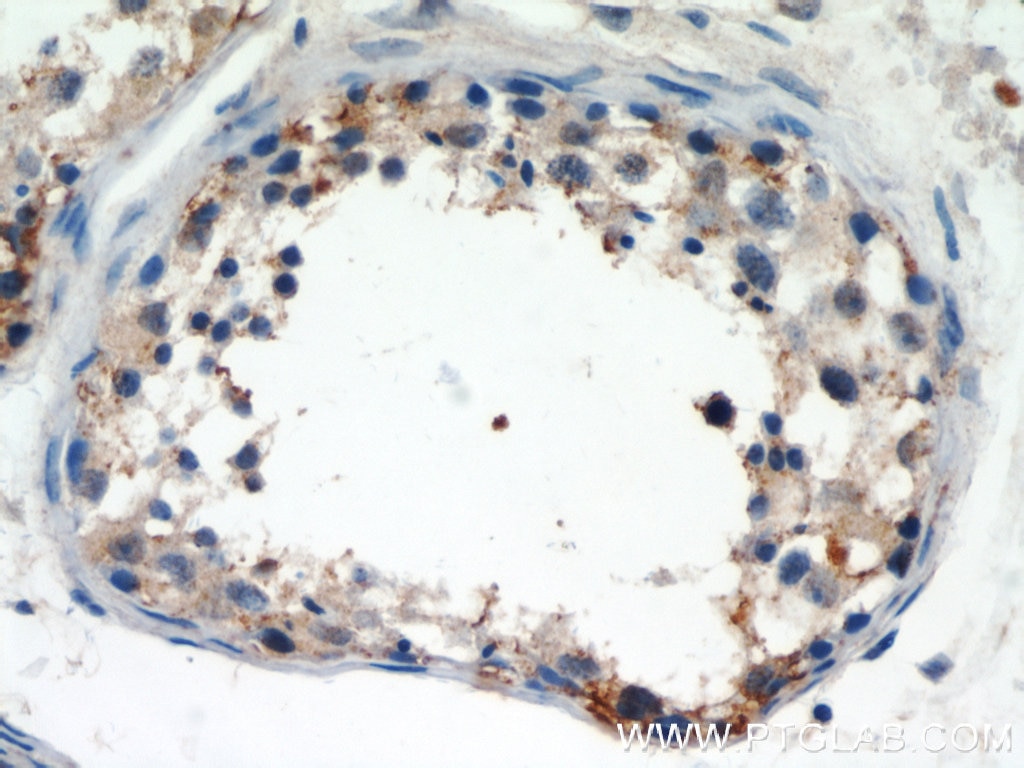 Immunohistochemistry (IHC) staining of human testis tissue using LIN41 Polyclonal antibody (55003-1-AP)