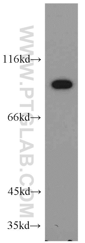 Western Blot (WB) analysis of mouse kidney tissue using LIN41 Polyclonal antibody (55003-1-AP)