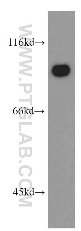 Western Blot (WB) analysis of NIH/3T3 cells using LIN41 Polyclonal antibody (55003-1-AP)