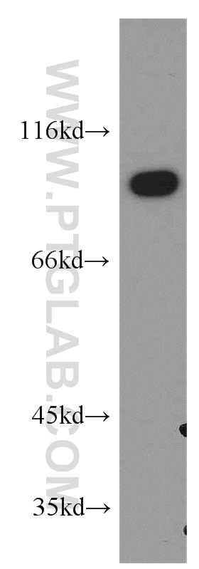 Western Blot (WB) analysis of DU 145 cells using LIN41 Polyclonal antibody (55003-1-AP)