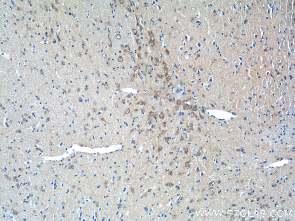 Immunohistochemistry (IHC) staining of mouse brain tissue using LIN7A Polyclonal antibody (25150-1-AP)