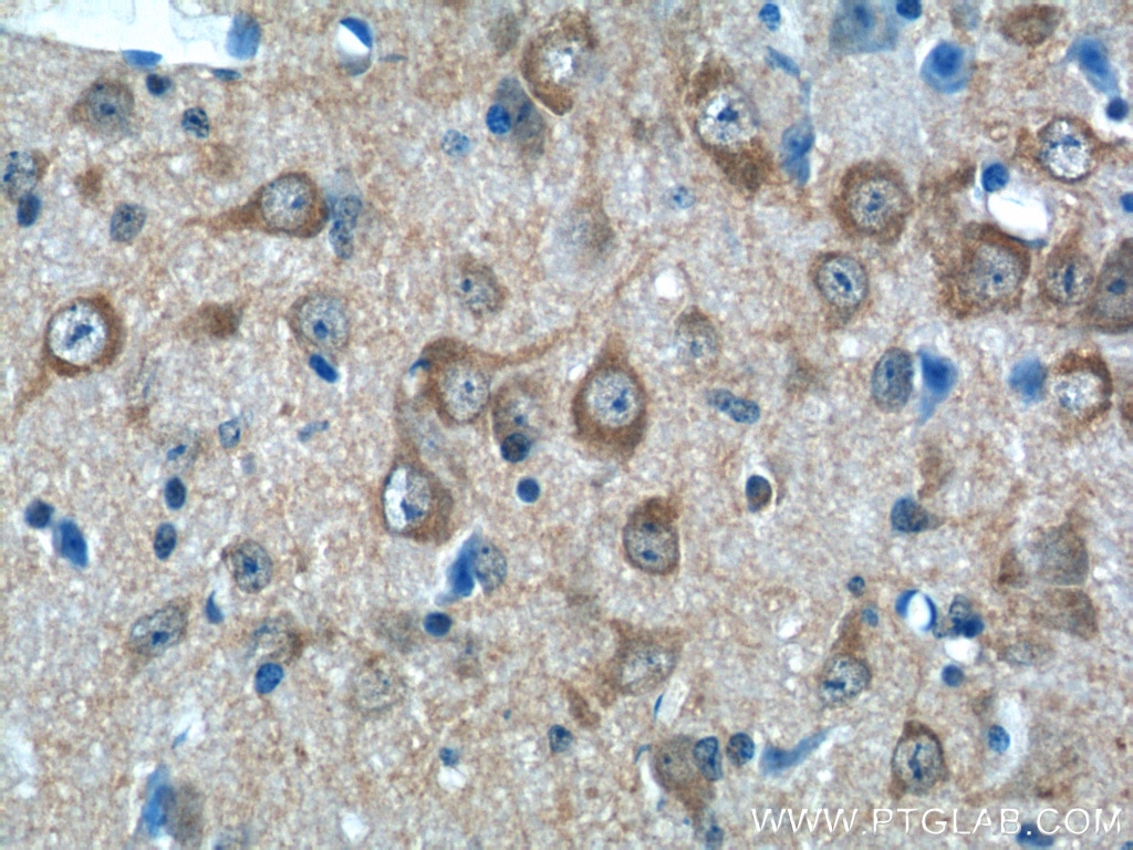 Immunohistochemistry (IHC) staining of mouse brain tissue using LIN7A Polyclonal antibody (25150-1-AP)