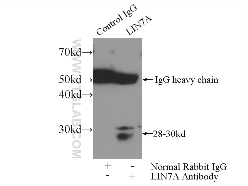 Immunoprecipitation (IP) experiment of mouse brain tissue using LIN7A Polyclonal antibody (25150-1-AP)