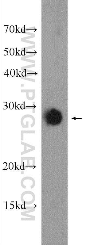 Western Blot (WB) analysis of rat brain tissue using LIN7A Polyclonal antibody (25150-1-AP)