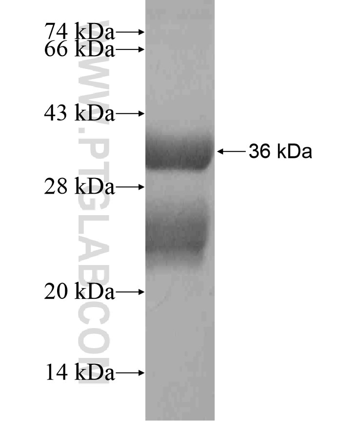 LIN7A fusion protein Ag18440 SDS-PAGE