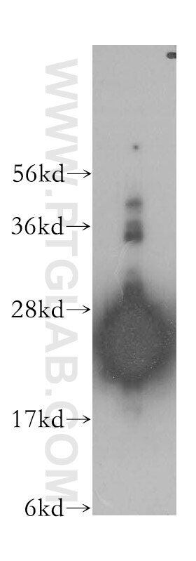 Western Blot (WB) analysis of human brain tissue using LIN7B Polyclonal antibody (12732-1-AP)