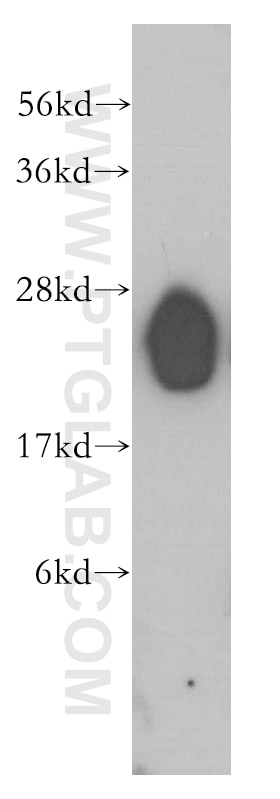 Western Blot (WB) analysis of human heart tissue using LIN7B Polyclonal antibody (12732-1-AP)