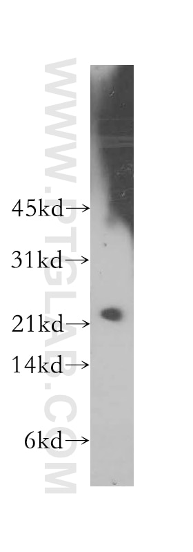 Western Blot (WB) analysis of K-562 cells using LIN7B Polyclonal antibody (12732-1-AP)