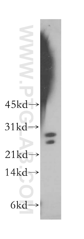 Western Blot (WB) analysis of A549 cells using LIN7B Polyclonal antibody (12732-1-AP)