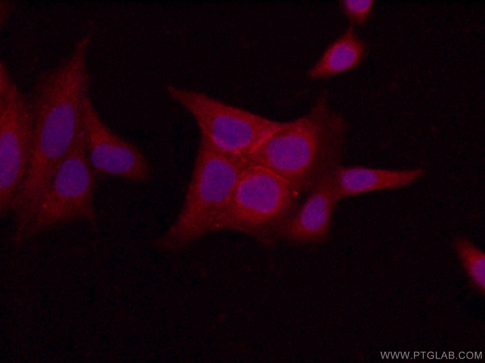 Immunofluorescence (IF) / fluorescent staining of HeLa cells using LIN7C Polyclonal antibody (14656-1-AP)