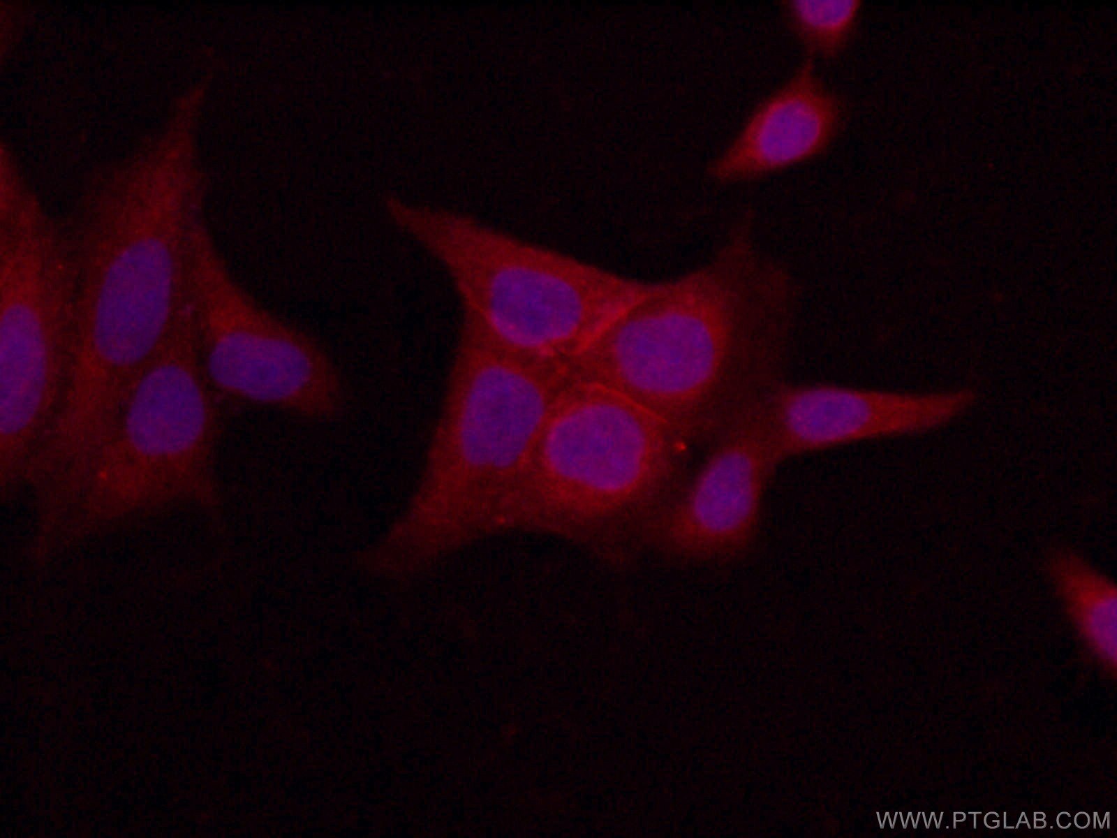 Immunofluorescence (IF) / fluorescent staining of HeLa cells using LIN7C Polyclonal antibody (14656-1-AP)