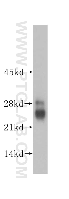 Western Blot (WB) analysis of human kidney tissue using LIN7C Polyclonal antibody (14656-1-AP)