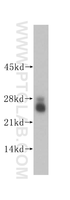 Western Blot (WB) analysis of human cerebellum tissue using LIN7C Polyclonal antibody (14656-1-AP)
