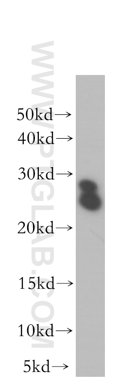 Western Blot (WB) analysis of human brain tissue using LIN7C Polyclonal antibody (14656-1-AP)