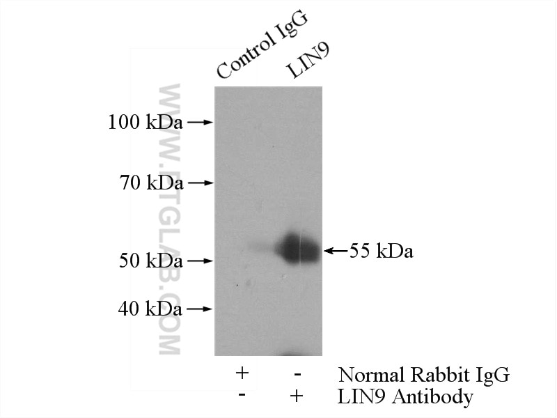 Immunoprecipitation (IP) experiment of HEK-293 cells using LIN9 Polyclonal antibody (17882-1-AP)