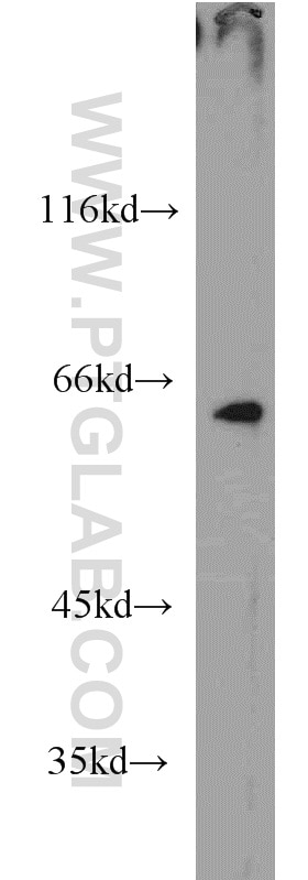 Western Blot (WB) analysis of HEK-293 cells using LIN9 Polyclonal antibody (17882-1-AP)