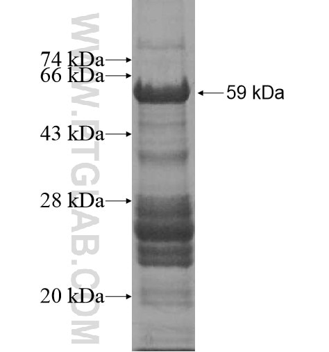 LIN9 fusion protein Ag11889 SDS-PAGE
