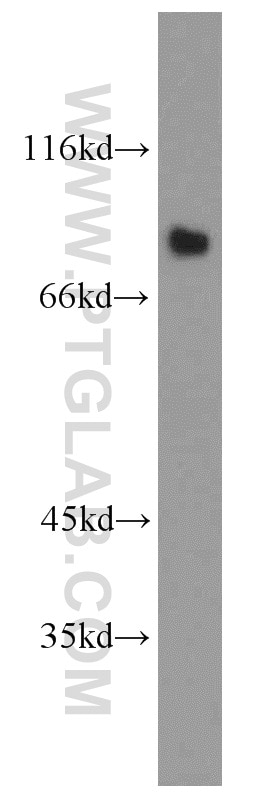 Western Blot (WB) analysis of mouse brain tissue using LINGO1 Polyclonal antibody (19097-1-AP)