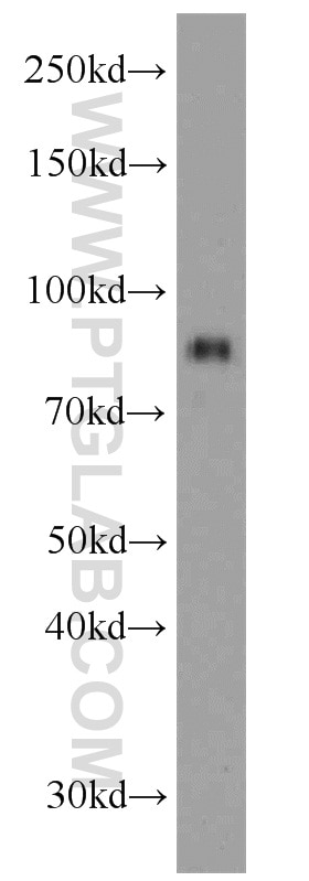 Western Blot (WB) analysis of rat brain tissue using LINGO1 Polyclonal antibody (19097-1-AP)