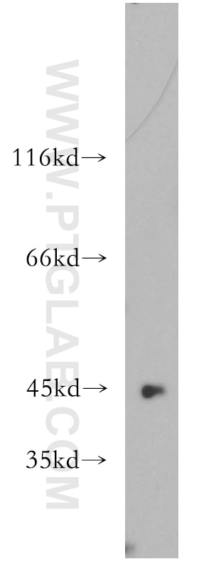 WB analysis of HeLa using 12956-1-AP