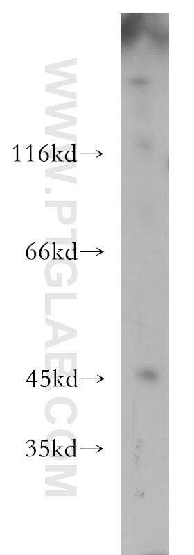 Western Blot (WB) analysis of HEK-293 cells using LIPA Polyclonal antibody (12956-1-AP)