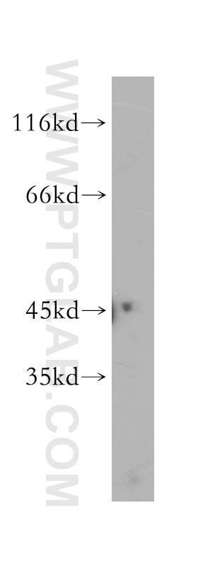 Western Blot (WB) analysis of HepG2 cells using LIPA Polyclonal antibody (12956-1-AP)