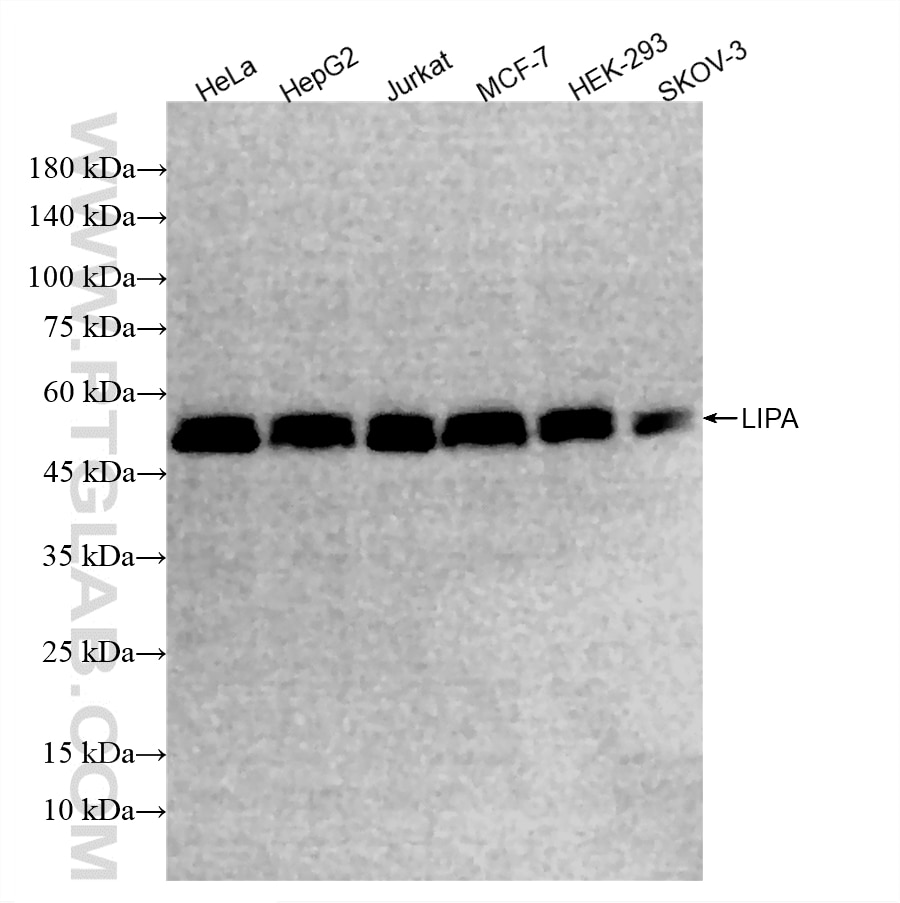 Various lysates were subjected to SDS PAGE followed by western blot with 85607-1-RR (LIPA antibody) at dilution of 1:2000 incubated at room temperature for 1.5 hours. This data was developed using the same antibody clone with 85607-1-PBS in a different storage buffer formulation. Western Blot (WB) analysis of various lysates using LIPA Recombinant monoclonal antibody (85607-1-RR)