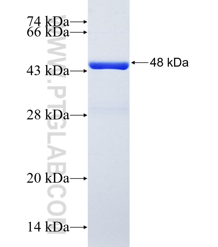 LIPA fusion protein Ag3627 SDS-PAGE