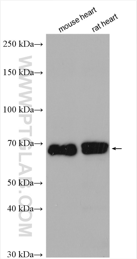 Western Blot (WB) analysis of various lysates using LIPC Polyclonal antibody (21133-1-AP)
