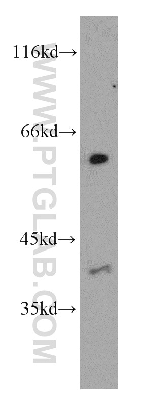 Western Blot (WB) analysis of mouse liver tissue using LIPC Polyclonal antibody (21133-1-AP)