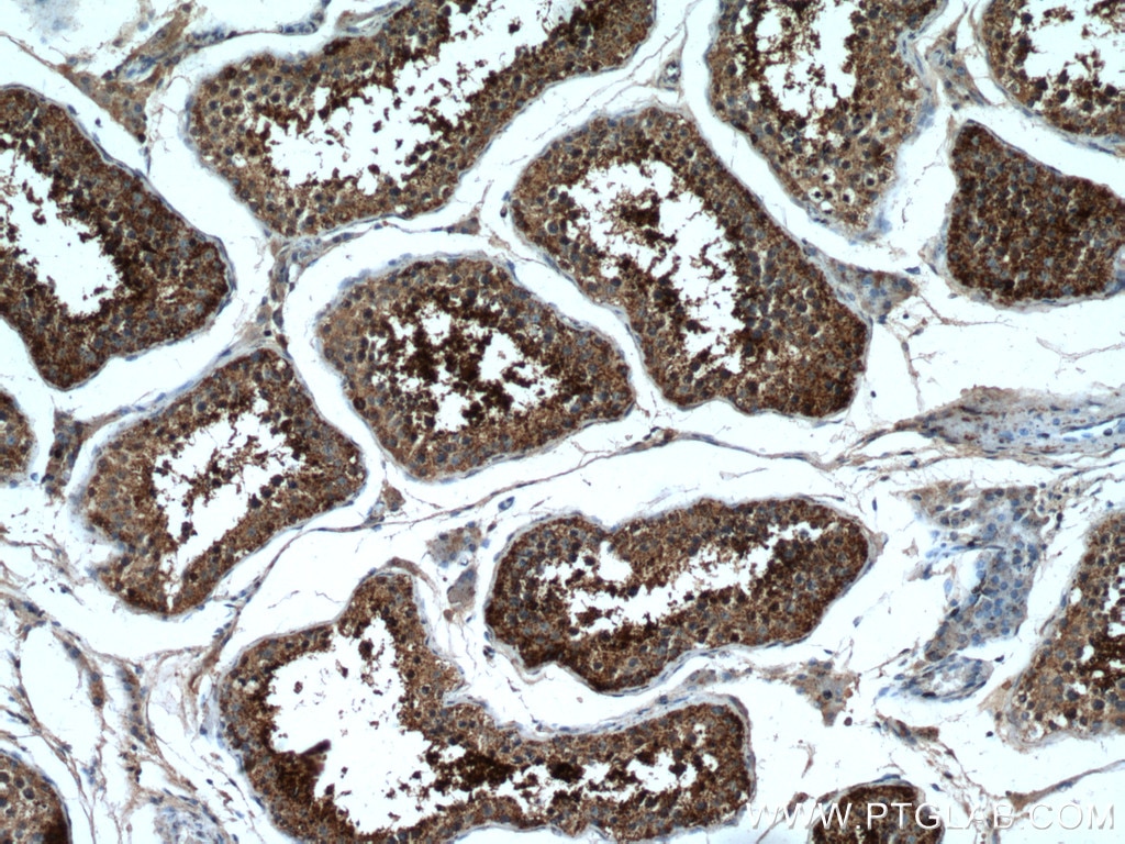 Immunohistochemistry (IHC) staining of human testis tissue using HSL Polyclonal antibody (17333-1-AP)