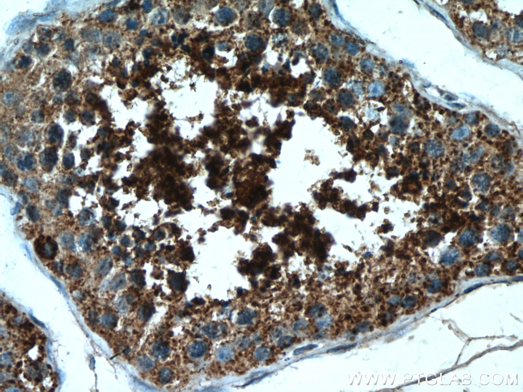 Immunohistochemistry (IHC) staining of human testis tissue using HSL Polyclonal antibody (17333-1-AP)