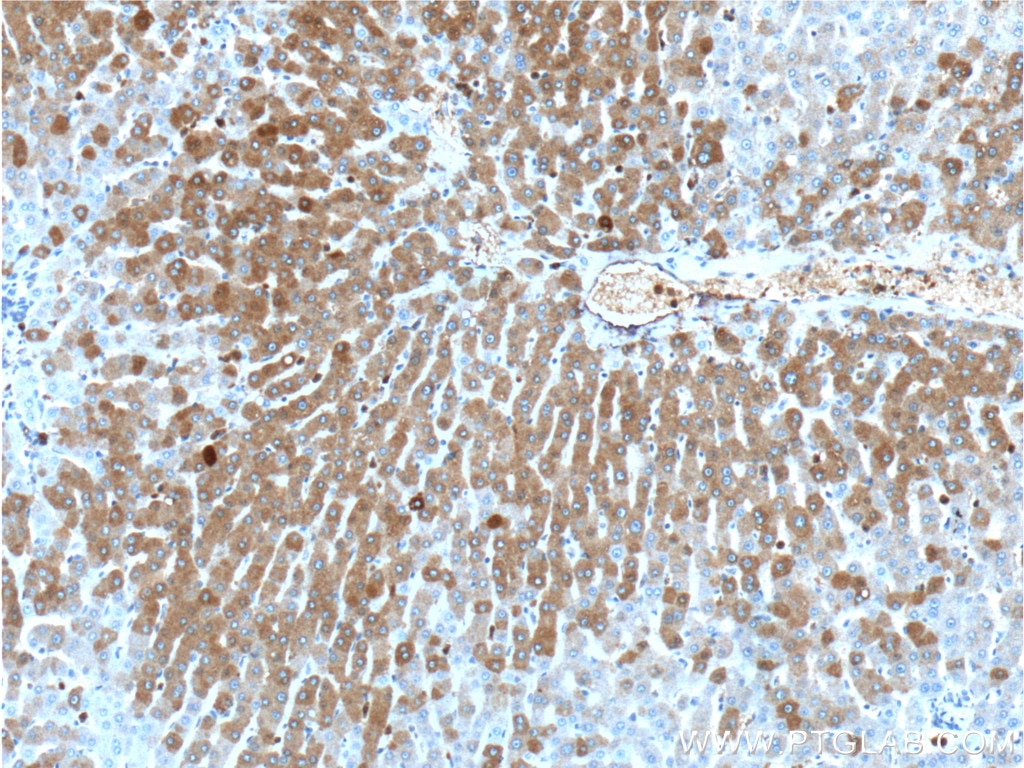 Immunohistochemistry (IHC) staining of human liver tissue using LIPF Polyclonal antibody (25889-1-AP)