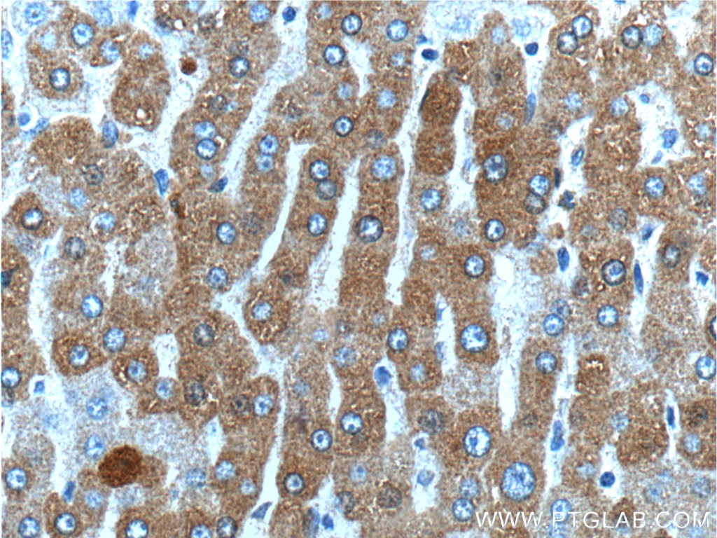 Immunohistochemistry (IHC) staining of human liver tissue using LIPF Polyclonal antibody (25889-1-AP)