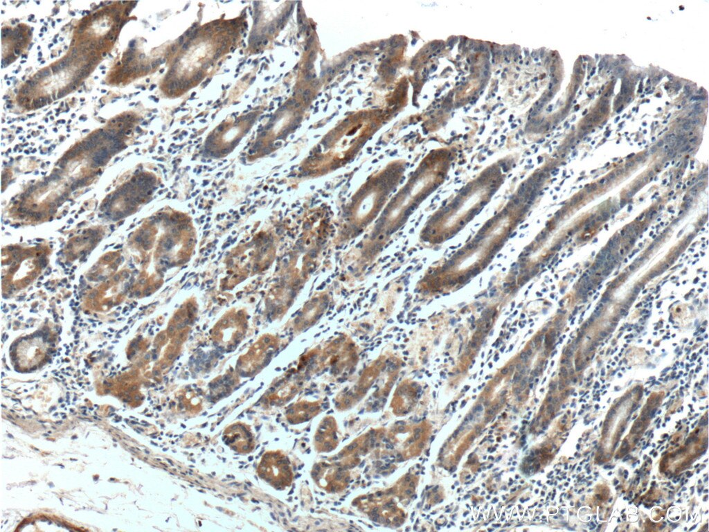 IHC staining of human stomach using 25889-1-AP