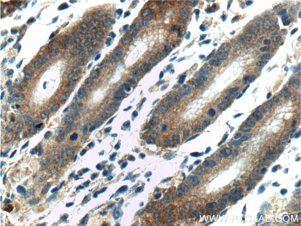 Immunohistochemistry (IHC) staining of human stomach tissue using LIPF Polyclonal antibody (25889-1-AP)