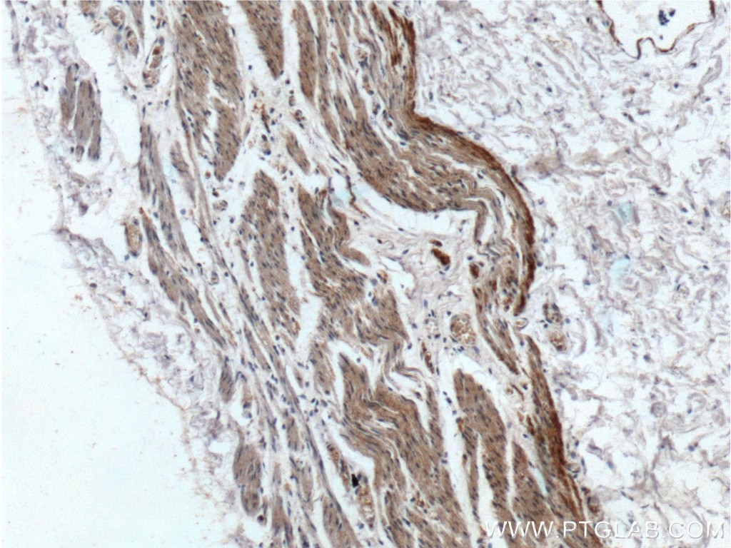 Immunohistochemistry (IHC) staining of human stomach tissue using LIPF Polyclonal antibody (25889-1-AP)